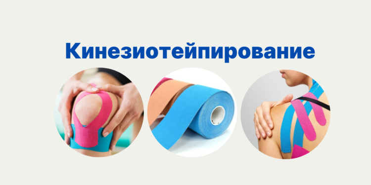 Кинезиотейпирование